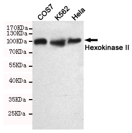 Western blot detection of Hexokinase II in COS7,K562 and Hela cell lysates using Hexokinase II mouse mAb (1:1000 diluted).Predicted band size:102KDa.Observed band size:102KDa.
