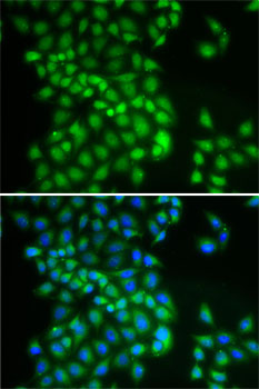 Immunofluorescence - YTHDC1 Polyclonal Antibody 