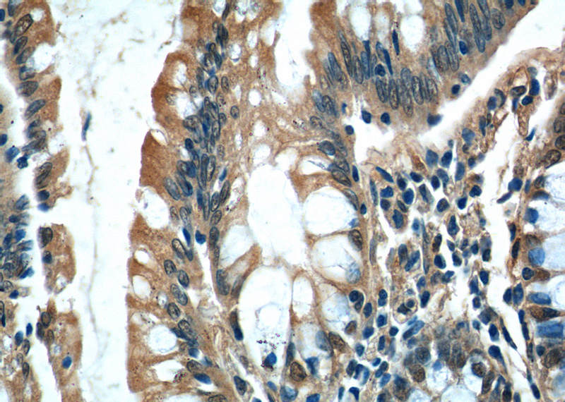 Immunohistochemistry of paraffin-embedded human colon tissue slide using Catalog No:112825(MRPL36 Antibody) at dilution of 1:50 (under 40x lens)
