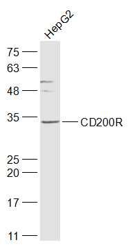 Fig4: Sample:; HepG2(Human) Cell Lysate at 30 ug; Primary: Anti-CD200R at 1/1000 dilution; Secondary: IRDye800CW Goat Anti-Rabbit IgG at 1/20000 dilution; Predicted band size: 34 kD; Observed band size: 34 kD