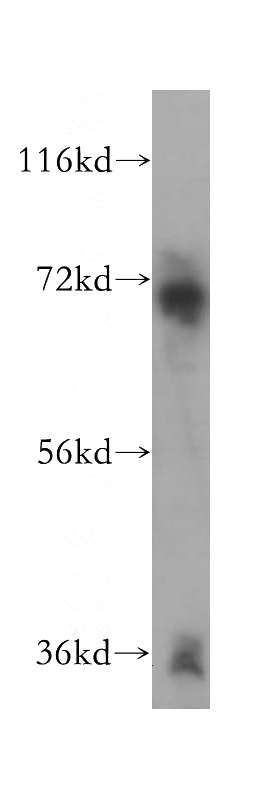 human brain tissue were subjected to SDS PAGE followed by western blot with Catalog No:110008(DMWD antibody) at dilution of 1:300