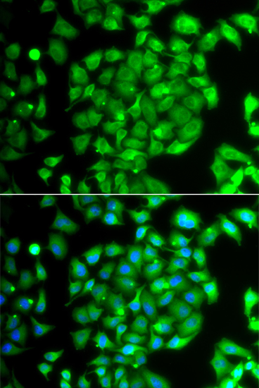 Immunofluorescence - MEOX1 Polyclonal Antibody 