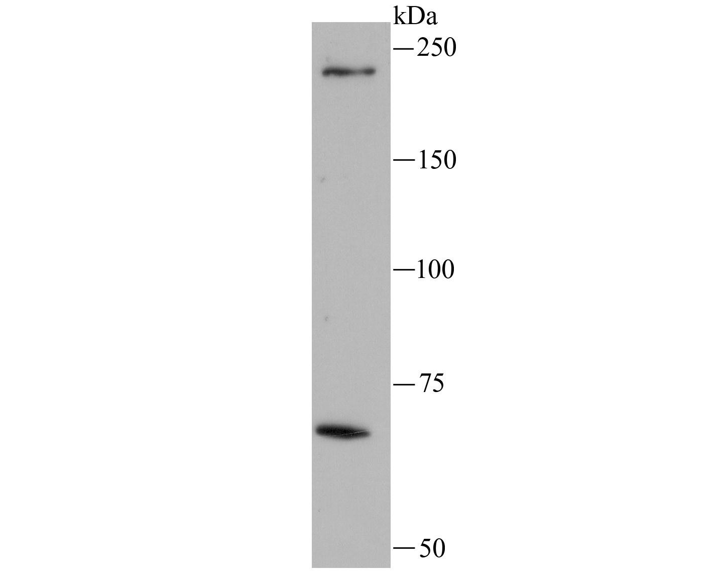 Fig1: Western blot analysis of LRRK1 on A549 lysate using anti-LRRK1 antibody at 1/100 dilution.