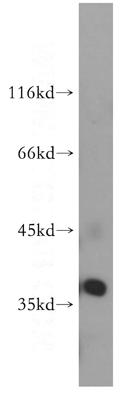 HeLa cells were subjected to SDS PAGE followed by western blot with Catalog No:108254(ARFIP2 antibody) at dilution of 1:500