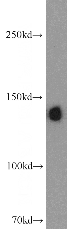 human blood tissue were subjected to SDS PAGE followed by western blot with Catalog No:109191(CP antibody) at dilution of 1:1000