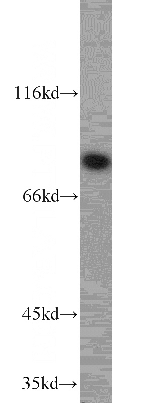 HeLa cells were subjected to SDS PAGE followed by western blot with Catalog No:111455(HPS6 antibody) at dilution of 1:300