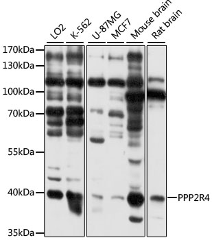 Western blot - PPP2R4 Polyclonal Antibody 
