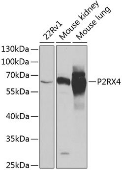Western blot - P2RX4 Polyclonal Antibody 