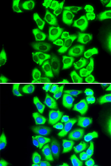 Immunofluorescence - RPS3A Polyclonal Antibody 