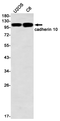 Western blot detection of cadherin 10 in U2OS,C6 using cadherin 10 Rabbit mAb(1:1000 diluted)