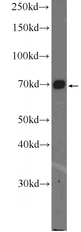 HeLa cells were subjected to SDS PAGE followed by western blot with Catalog No:110703(FOXO1 Antibody) at dilution of 1:600
