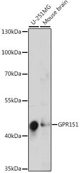 Western blot - GPR151 Polyclonal Antibody 