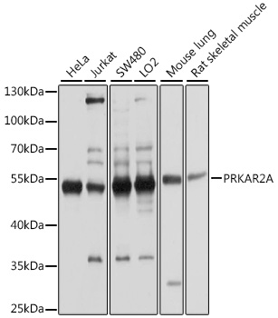 Western blot - PRKAR2A Polyclonal Antibody 