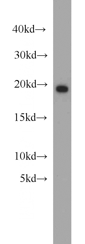 mouse brain tissue were subjected to SDS PAGE followed by western blot with Catalog No:108555(BUD31 antibody) at dilution of 1:2000