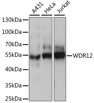 Western blot - WDR12 Polyclonal Antibody 