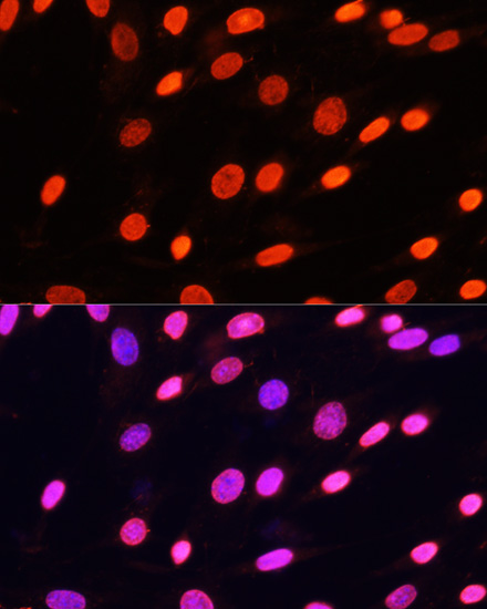 Immunofluorescence - Pan DiMethyl-lysine pAb 