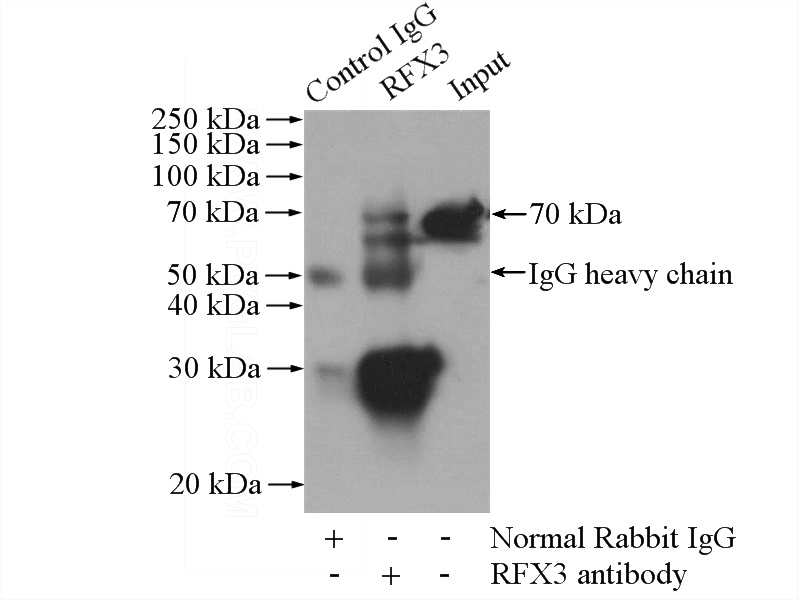 IP Result of anti-RFX3 (IP:Catalog No:114634, 4ug; Detection:Catalog No:114634 1:500) with HeLa cells lysate 1400ug.