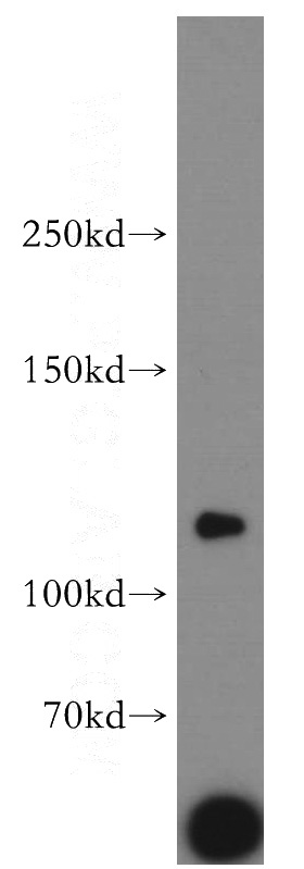 human brain tissue were subjected to SDS PAGE followed by western blot with Catalog No:112289(LNPEP antibody) at dilution of 1:800