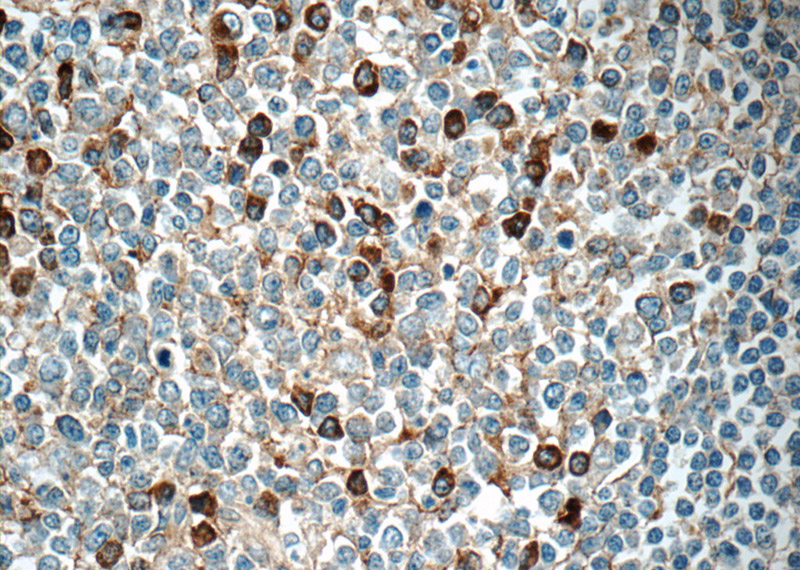 Immunohistochemistry of paraffin-embedded human tonsillitis tissue slide using Catalog No:111632(IGJ Antibody) at dilution of 1:50 (under 40x lens)