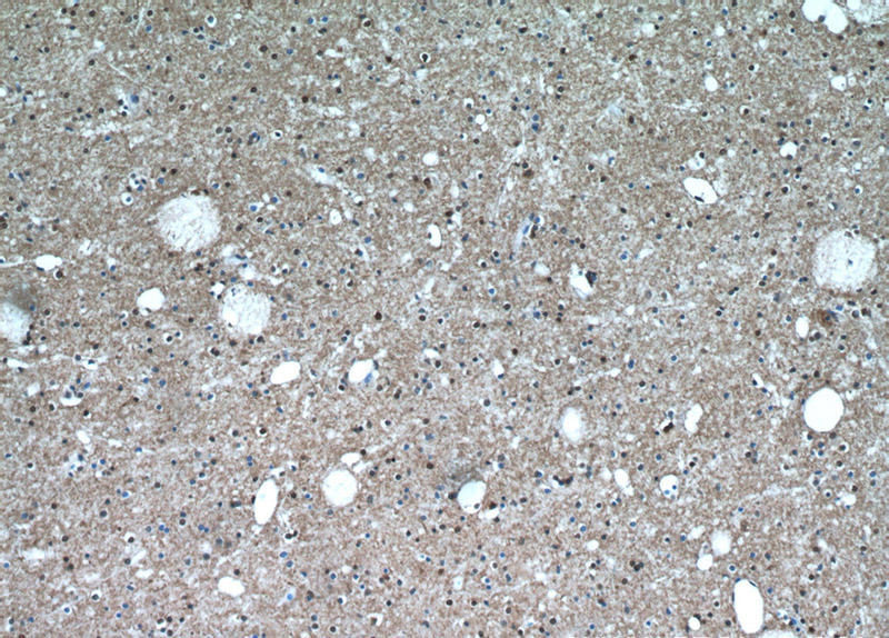 Immunohistochemical of paraffin-embedded human brain using Catalog No:115985(TAF1-Specific antibody) at dilution of 1:100 (under 10x lens)