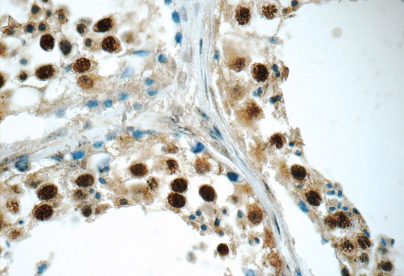 Immunohistochemistry of paraffin-embedded human testis tissue slide using Catalog No:113577(PAPOLG Antibody) at dilution of 1:50 (under 40x lens)