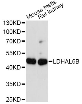 Western blot - LDHAL6B Polyclonal Antibody 