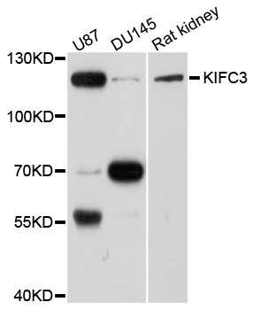 Western blot - KIFC3 Polyclonal Antibody 