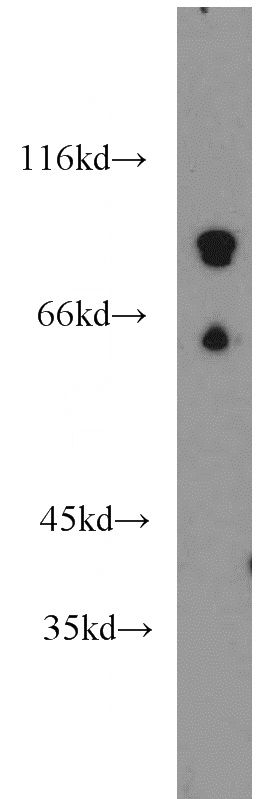 mouse brain tissue were subjected to SDS PAGE followed by western blot with Catalog No:113698(PCDHB12 antibody) at dilution of 1:800