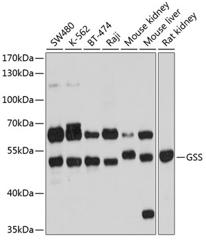 Western blot - GSS Polyclonal Antibody 