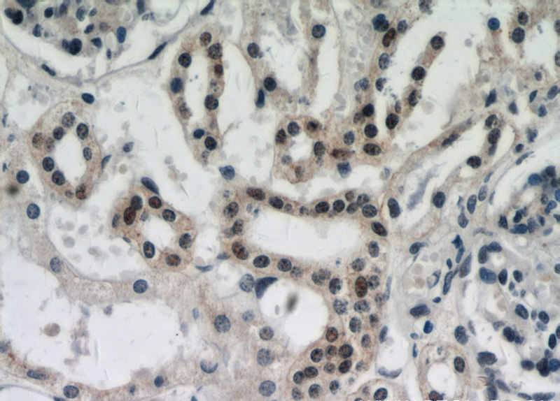 Immunohistochemical of paraffin-embedded human kidney using Catalog No:109781(DDX17,P72 antibody) at dilution of 1:800 (under 40x lens)