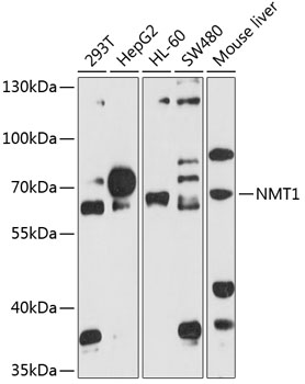 Western blot - NMT1 Polyclonal Antibody 