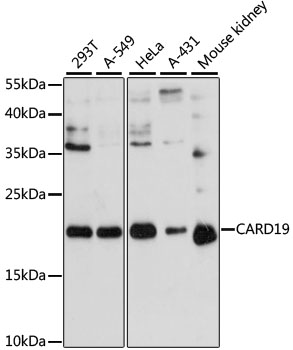Western blot - CARD19 Polyclonal Antibody 