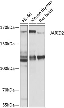 Western blot - JARID2 Polyclonal Antibody 