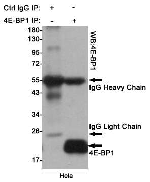 Immunoprecipitation analysis of Hela cell lysates using 4E-BP1 Rabbit pAb.