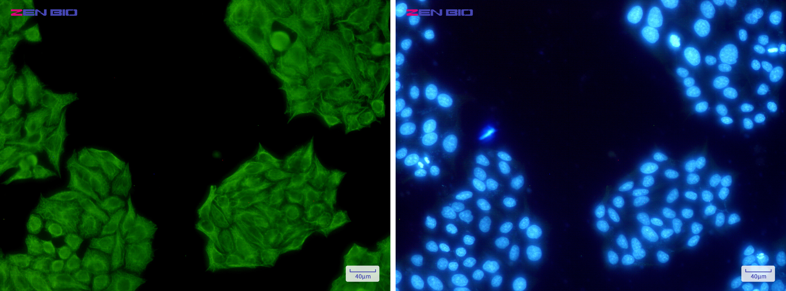 Immunocytochemistry of Cytokeratin 8(green) in Hela cells using Cytokeratin 8 Rabbit pAb at dilution 1/50, and DAPI(blue)