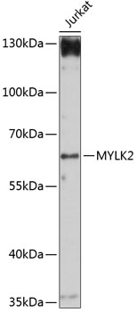 Western blot - MYLK2 Polyclonal Antibody 