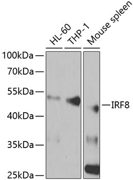 Western blot - IRF8 Polyclonal Antibody 
