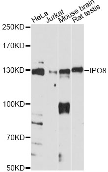 Western blot - IPO8 Polyclonal Antibody 