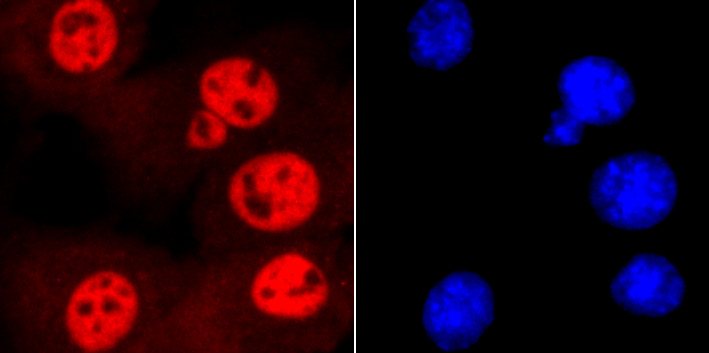 Fig4: ICC staining SMC3 in NIH-3T3 cells (red). The nuclear counter stain is DAPI (blue). Cells were fixed in paraformaldehyde, permeabilised with 0.25% Triton X100/PBS.