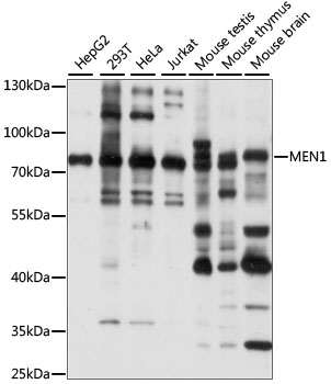 Western blot - MEN1 Polyclonal Antibody 
