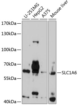 Western blot - SLC1A6 Polyclonal Antibody 