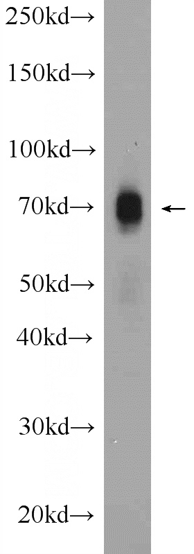 rat spleen tissue were subjected to SDS PAGE followed by western blot with Catalog No:109644(CXCR4 Antibody) at dilution of 1:1000