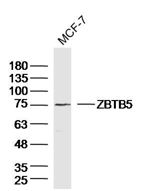Fig1: Sample:MCF-7 (Human)cell Lysate at 40 ug; Primary: Anti-ZBTB5 at 1/300 dilution; Secondary: IRDye800CW Goat Anti-RabbitIgG at 1/20000 dilution; Predicted band size: 74kD; Observed band size: 75kD