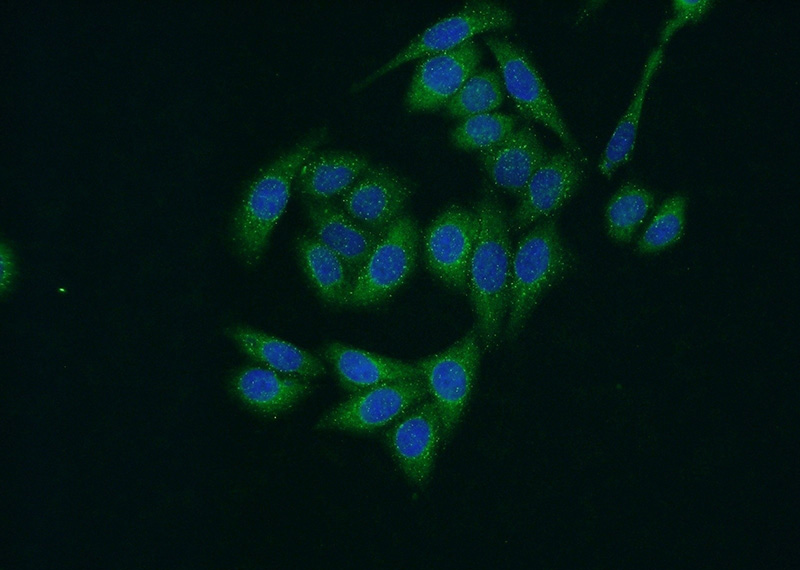 Immunofluorescent analysis of HeLa cells using Catalog No:117045(ZFYVE16 Antibody) at dilution of 1:50 and Alexa Fluor 488-congugated AffiniPure Goat Anti-Rabbit IgG(H+L)