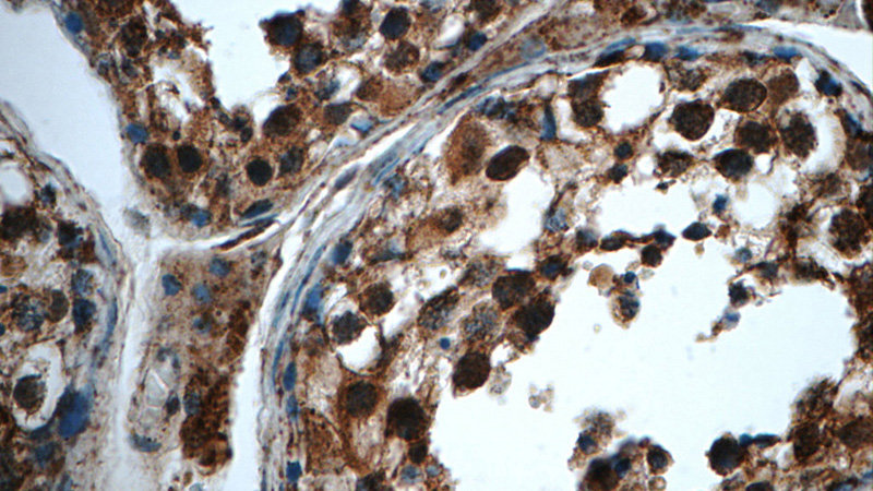 Immunohistochemistry of paraffin-embedded human testis tissue slide using Catalog No:115381(SMC4 Antibody) at dilution of 1:50 (under 40x lens)