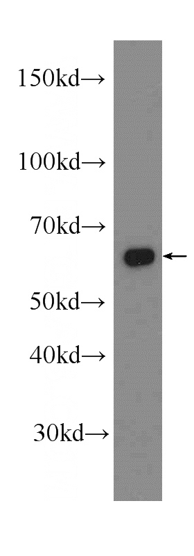 Jurkat cells were subjected to SDS PAGE followed by western blot with Catalog No:107851(AIF antibody) at dilution of 1:2000