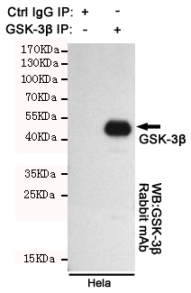 Immunoprecipitation analysis of Hela cell lysates using GSK3 beta (2E6) Mouse mAb.GSK-3 beta Rabbit mAb was used for the western blot analysis (1:1000 diluted).