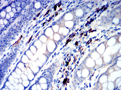 Fig3: Immunohistochemical analysis of paraffin-embedded human colon tissues using anti-IGLC2 antibody. Counter stained with hematoxylin.
