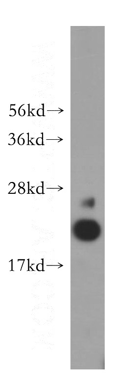 human testis tissue were subjected to SDS PAGE followed by western blot with Catalog No:107793(ADI1 antibody) at dilution of 1:400