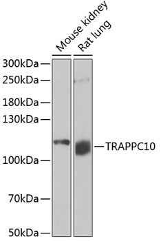 Western blot - TRAPPC10 Polyclonal Antibody 